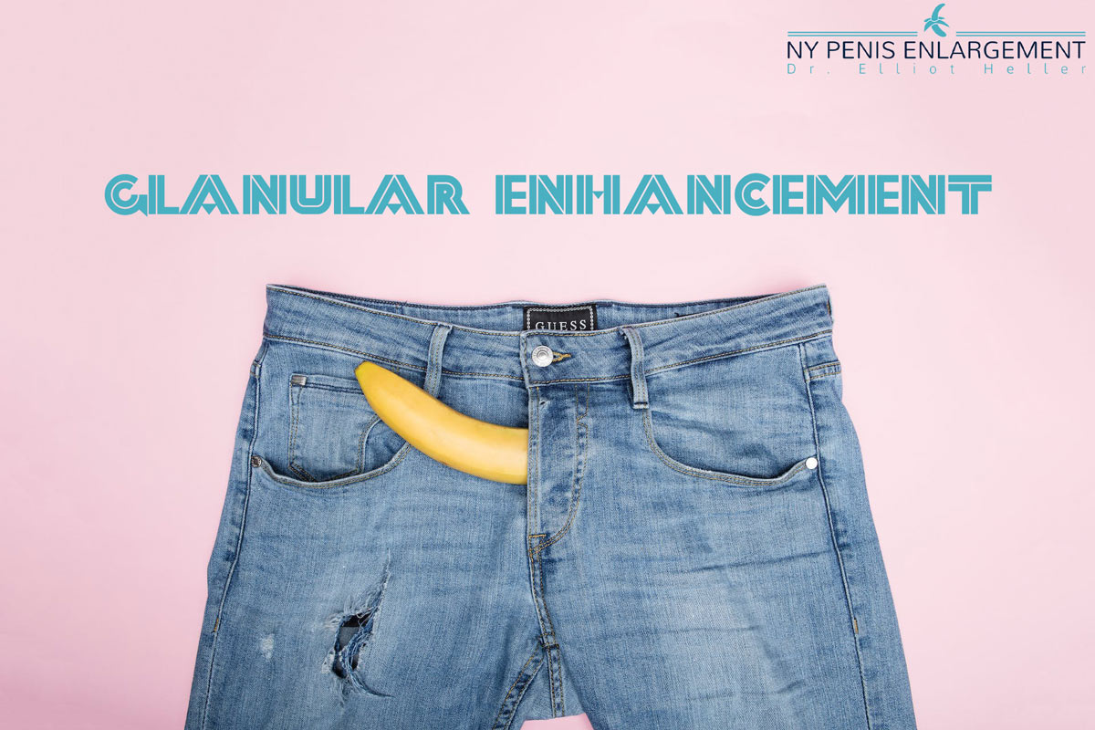 Glanular enhancement for the head of the penis with filler in New York and New Jersey with Dr. Elliot Heller